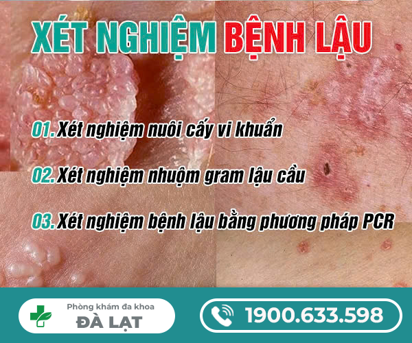 Hình ảnh minh họa